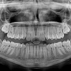 RV Dentistree in Nallagandla