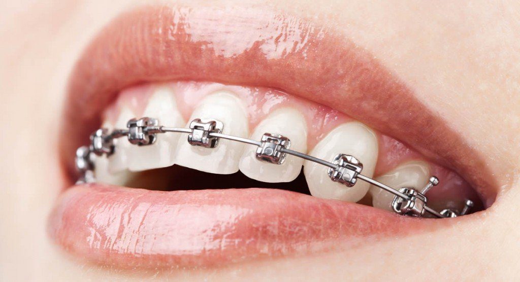 RV Dentistree in Nallagandla