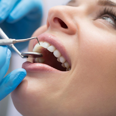 RV Dentistree in Nallagandla