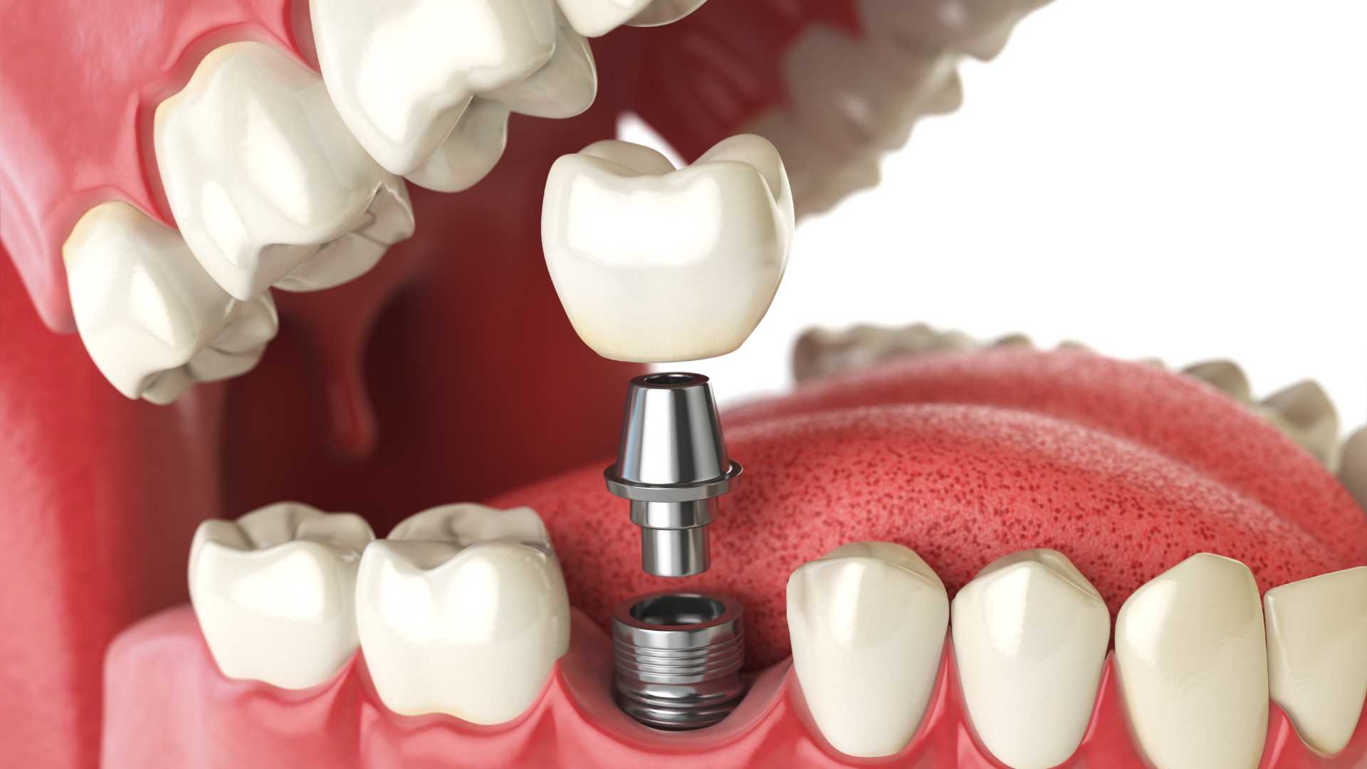 RV Dentistree in Nallagandla