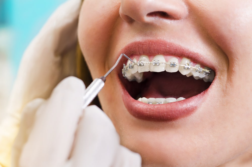 RV Dentistree in Nallagandla