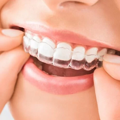 RV Dentistree in Nallagandla