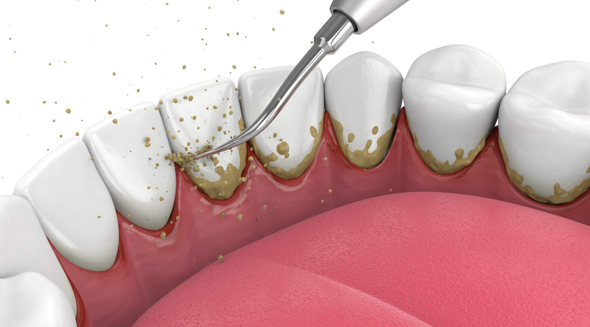 RV Dentistree in Nallagandla