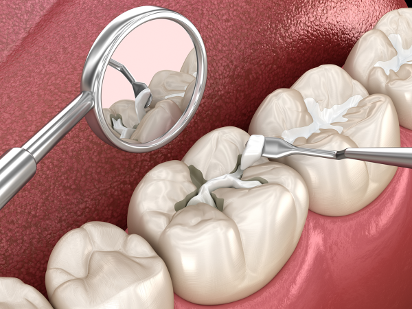 RV Dentistree in Nallagandla