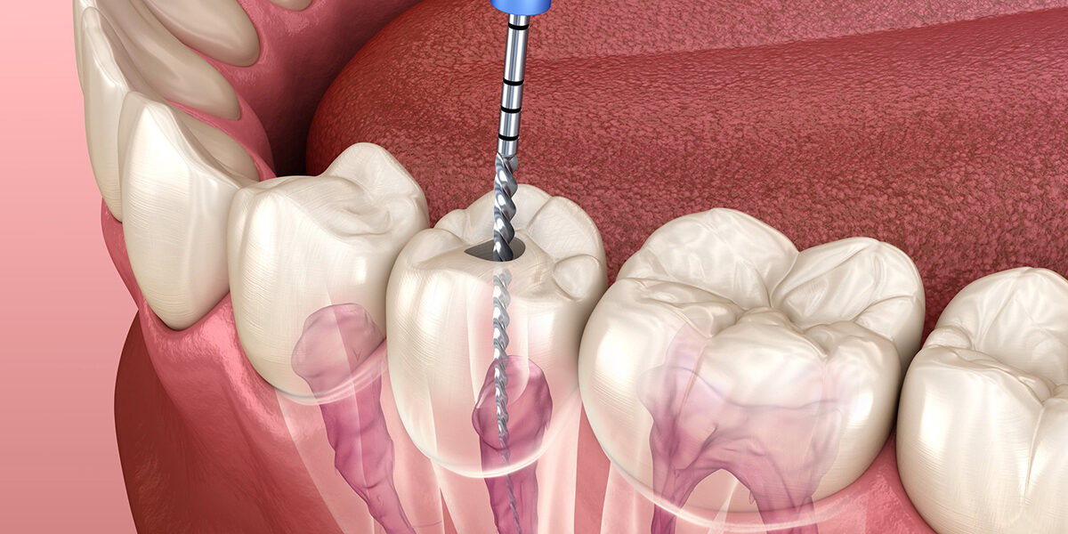 RV Dentistree in Nallagandla